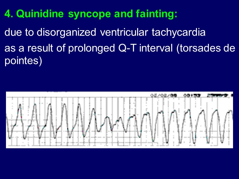 4. Quinidine syncope and fainting: due to disorganized ventricular tachycardia  as a result